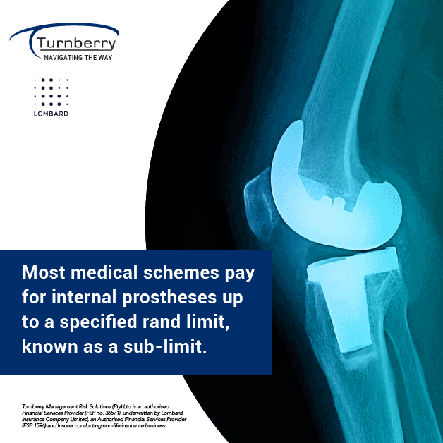 Sub-Limits Client testimonial